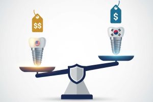 ترازویی که کیفیت و قیمت ایمپلنت آمریکایی را با ایمپلنت کره‌ای مقایسه می‌کند