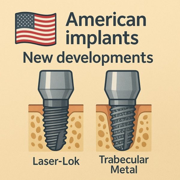 نوآوری‌های سطح ایمپلنت‌های آمریکایی: از Laser-Lok تا Trabecular Metal