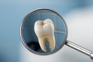 تصویر ماکرو از سر آینه دندانپزشکی فلزی استیل ضد زنگ